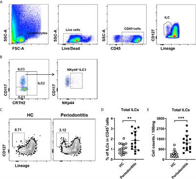 ILC1s and ILC3s Exhibit Inflammatory Phenotype in Periodontal Ligament of Periodontitis Patients